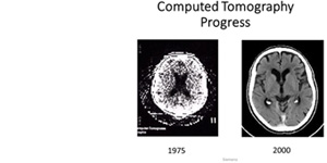 Computed Tomography Process: 1975 - 2000