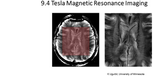 9.4 Tesla Magnetic Resonance Imaging