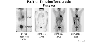 Positron Emission Tomography Progress