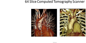 64 Slice Computed Tomography Scanner