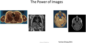 These two image sets show modern clinical images (right) and their anatomic (left) comparisons.