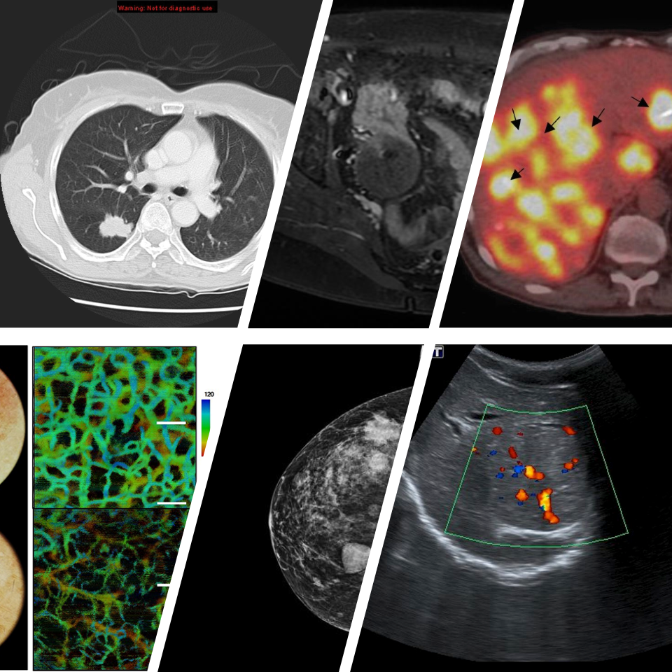 Cancer Imaging Types
