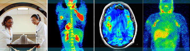 Cancer Imaging Program