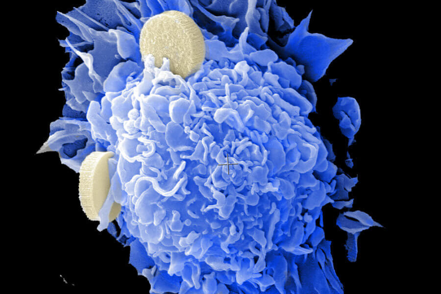 A dendritic cell, colored in blue and composed of many small overlapping flaps, has two cream-colored discs floating against it, one on top and one on the right. The image appears to be an electron microscope image.
