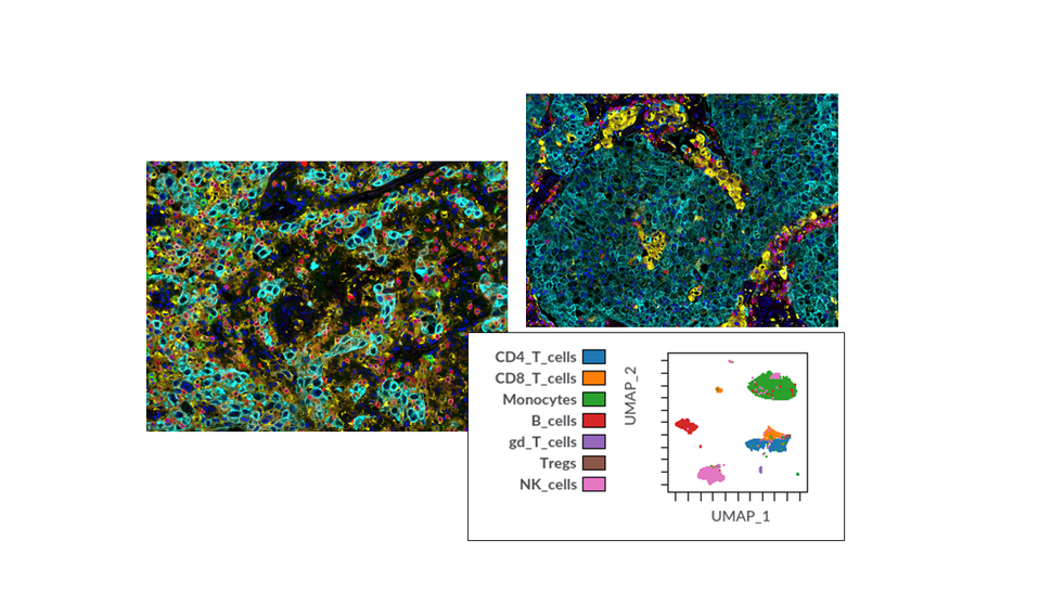 Images showing examples of multiplex immunofluorescence in tissue (two top images) and an example of a UMAP plot showing cell populations detected by CyTOF, including CD4 cells, CD8 cells, monocytes, B cells, gd T cells, Treg cells, and NK cells.