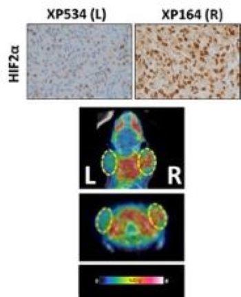 PET tracer reads out HIF2α in patient kidney tumors transplanted in mice. Microscopic and Macroscopic images provided.