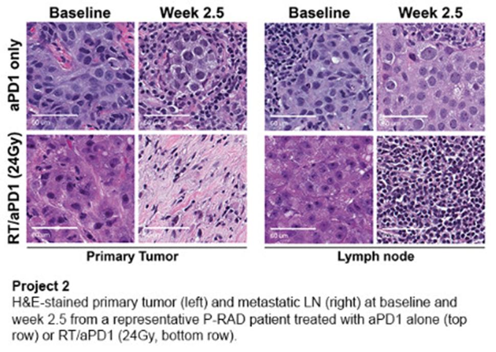H and E-stained primary tumor and metastatic lymph node at baseline and week 2.5