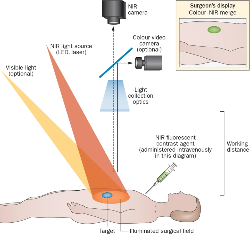 Diagram showing NIR imaging in surgery: a light source, optics, and cameras focus on a patient's target area with a contrast agent, displayed on a monitor.