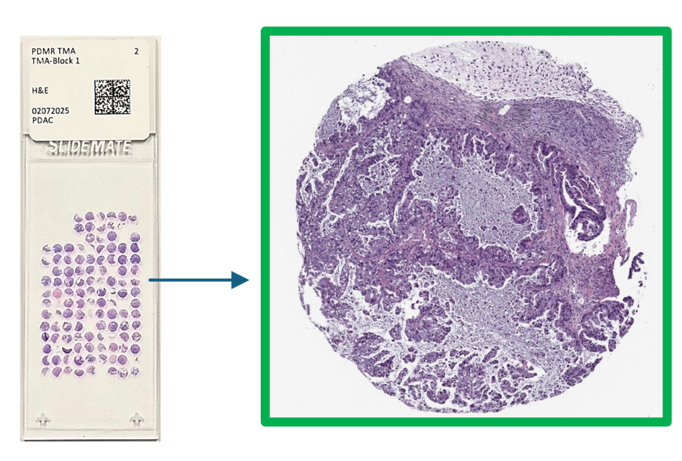 TMA slide on the left showing 120 small pieces of tumor tissue cut from PDX models, and on the right, a highly magnified image of one of those samples of the PDX tumor