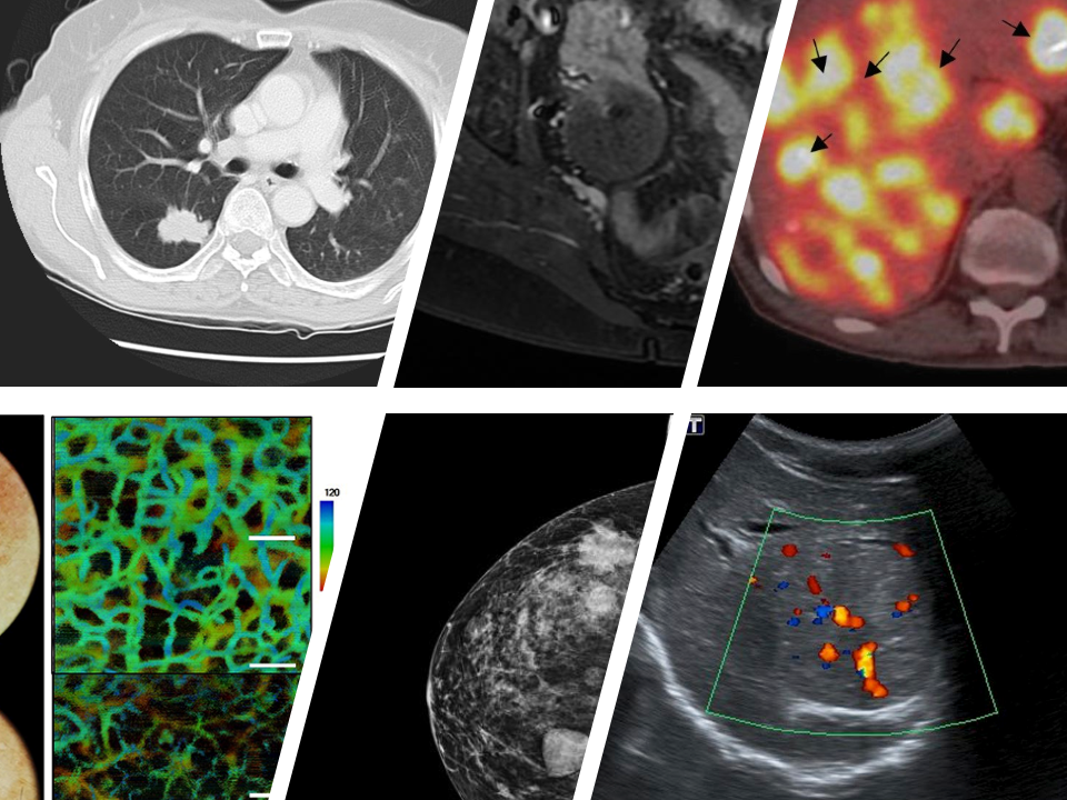 Cancer Imaging Basics - NCI