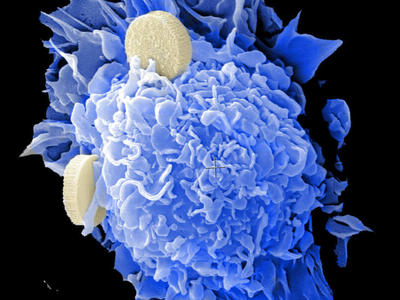 A dendritic cell, colored in blue and composed of many small overlapping flaps, has two cream-colored discs floating against it, one on top and one on the right. The image appears to be an electron microscope image.