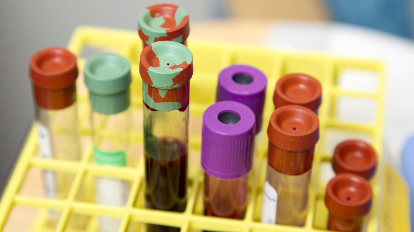 Vials of blood sitting in a rack